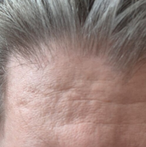 anonymous_forehead_context_crop_v2 (1)