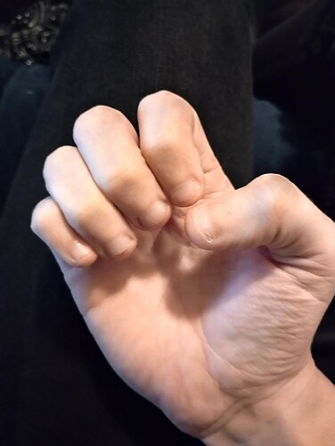 1000001116