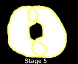 stage5